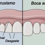 ¿Cómo Dejar de Apretar los Dientes Durante el Día: Tensiones de la Mandíbula y su Significado Emocional?