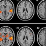 ¿Música en la cabeza: síntoma de ansiedad o pasión musical?